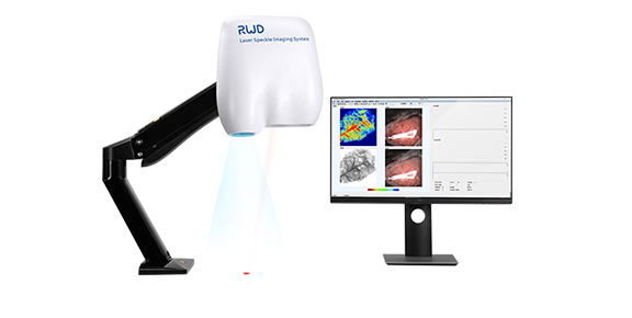 1-激光散斑血流成像系統.jpg