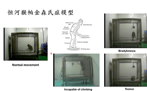 腦血管疾病動物模型領域有哪些創新技術？